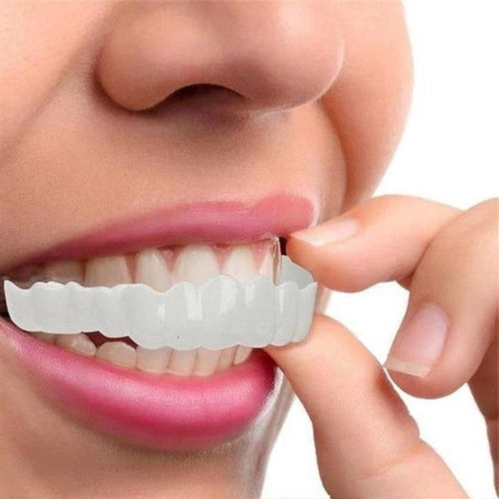 Teeth Veneer Cosmetic Cover Set Smile Enhancement