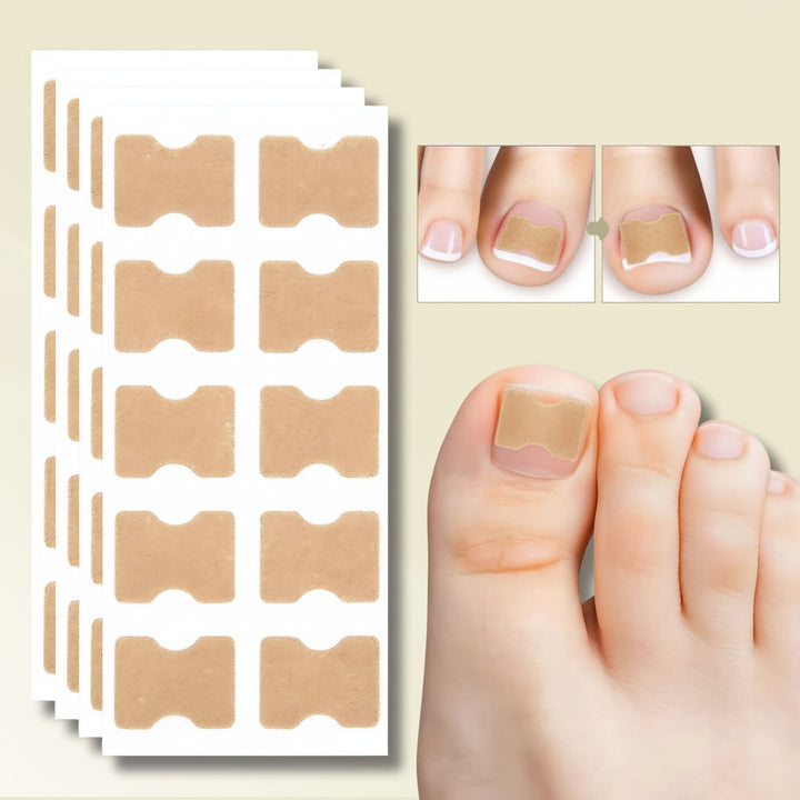 Toenail Corrector Patches Ingrown Nail Treatment