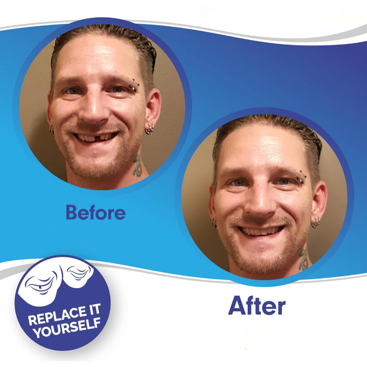 Teeth Veneer Cosmetic Cover Set Smile Enhancement