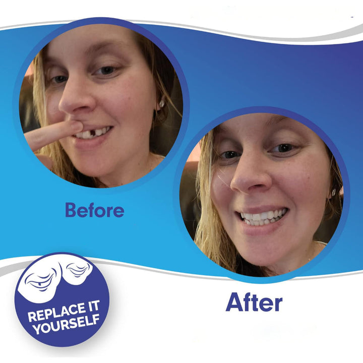 Teeth Veneer Cosmetic Cover Set Smile Enhancement