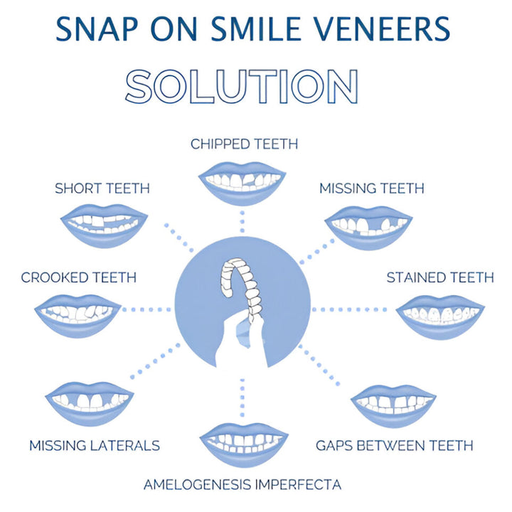 Teeth Veneer Cosmetic Cover Set Smile Enhancement